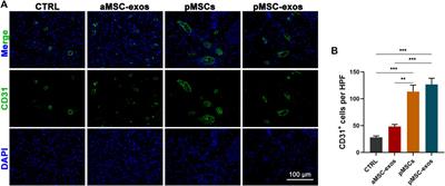 Placental stem cells-derived exosomes stimulate cutaneous wound regeneration via engrailed-1 inhibition